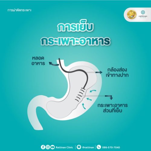 Baritric-Sergery4-768x768